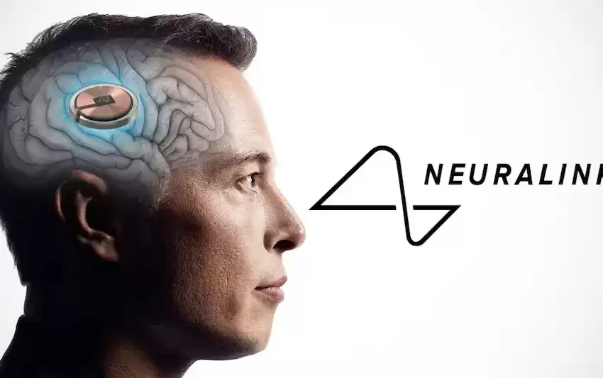 Neuralink brain-computer interface